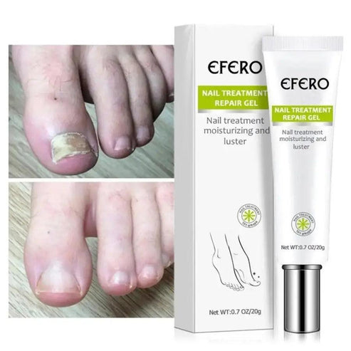 fungal nail treatment