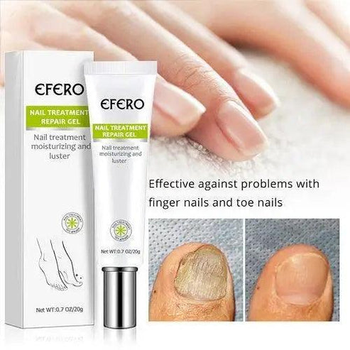 fungal nail treatment